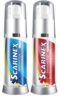 Scarinex scar gel and cream remover