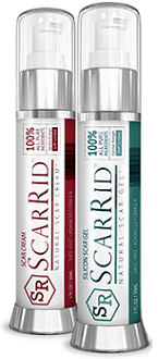 ScarRid gel and cream for scar removal