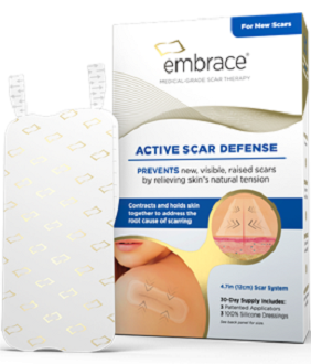 Embrace Active Scar Defense Review